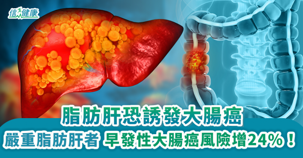 脂肪肝恐誘發大腸癌