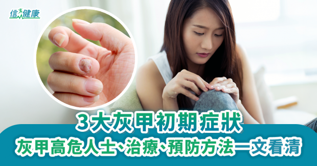 灰甲初期｜3大灰甲初期症狀　灰甲高危人士、治療、預防方法一文看清