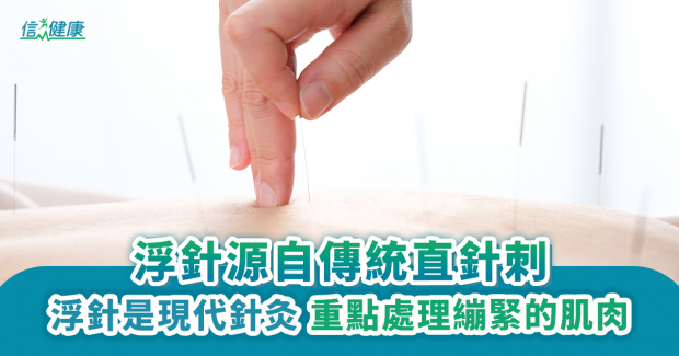 浮針源自傳統直針刺